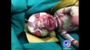 تولد نوزادی عجیب در ایران