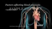 بیماری فشار خون چیست(دوبله)