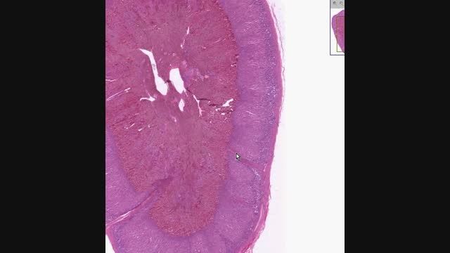 Shotgun Histology Adrenal