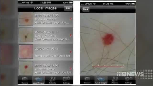 استفاده از تلفن هوشمند در تشخیص بیماریهای پوستی