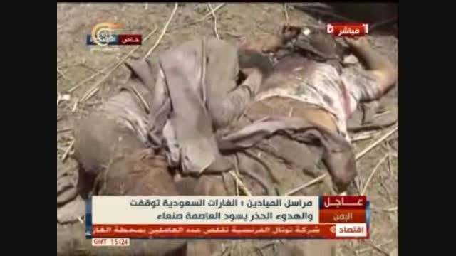 جنایات دیروز آل سعود در یمن در پناهگاه های اوارگان