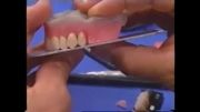 چیدن دندان با ماژور پلاس قسمت سوم