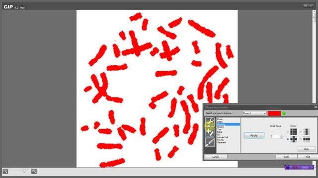 کاربرد نرم افزار پردازش تصویر در کاریوتایپ کروموزوم