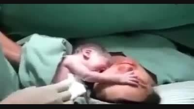 این نوزاد تازه متولدشده همینکه ازمادرجداشده گریه کرده