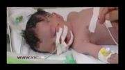 تولد نوزاد فلسطینی پس از شهادت مادر + عکس و فیلم