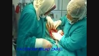 عمل جراحی سزارین ( زایمان ) دو قلو
