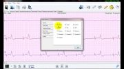 نرم افزار تحلیل سیگنال هولتر ECG نسخه 3 -امکانات بصری