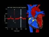 انیمیشن تغییرات ECG در سیستول و دیاستولECG Animation - Electrical Changes in Heart animation