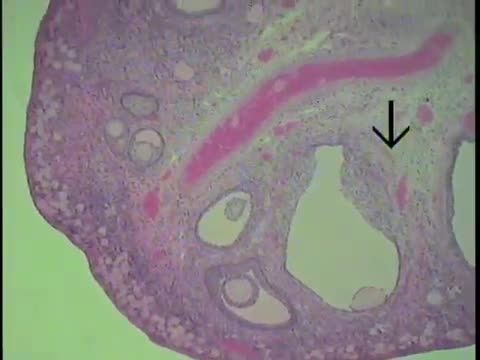 Female Reproductive Histology- Ovary (FreeMedEd)