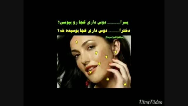 نظر سنجی 15