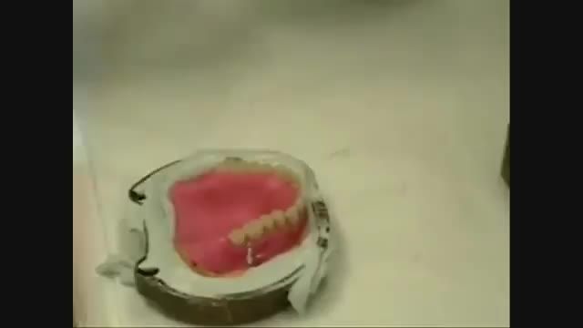 فرایند تولید دندان های مصنوعی