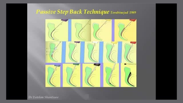 آموزش تکنیک پاسیو استپ بک (Passive Step Back Technique)