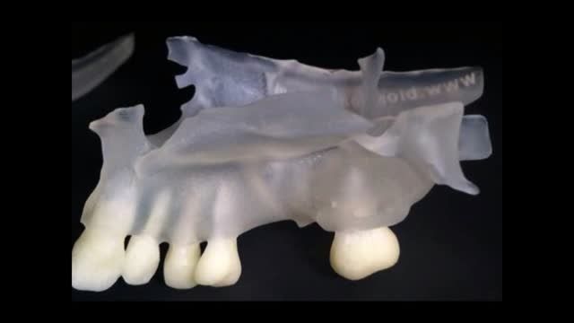 پرینتر سه بعدی برای دندانپزشکی