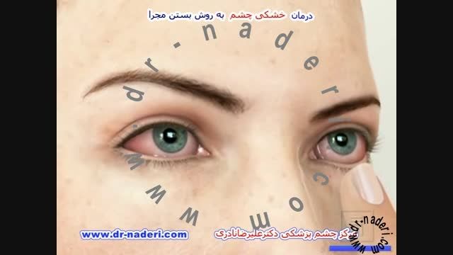 درمان خشکی چشم با بستن مجرای- مرکز چشم پزشکی دکتر نادری