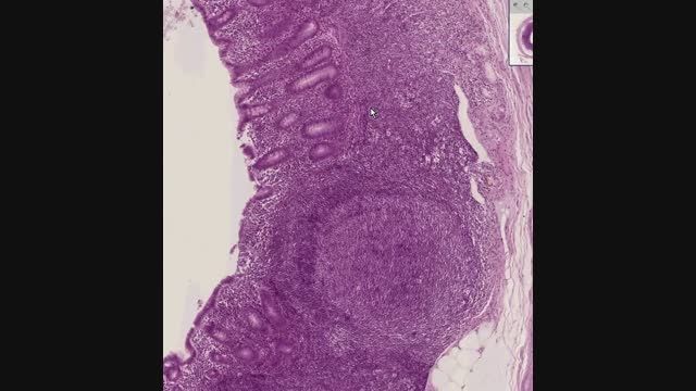 Shotgun Histology Appendix