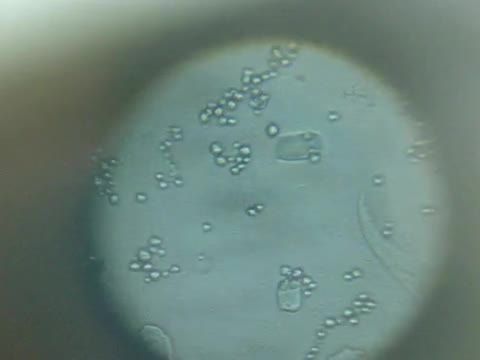 بررسی میکروسکوپی انتاموبا هیستولیتیکا