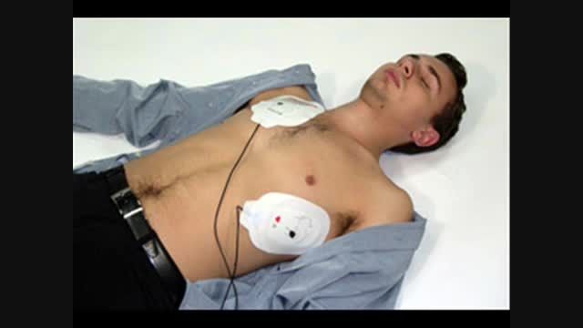 آموزش احیاء -کار با دستگاه AED