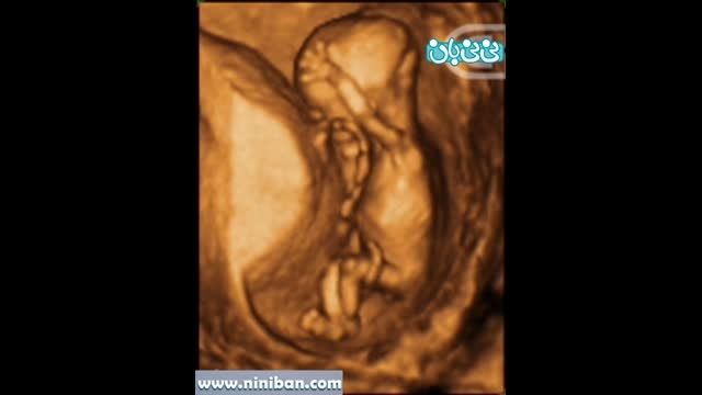 سونوگرافی چهار بعدی در بارداری هفته چهاردهم