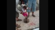 راه رفتن نوزاد یک داعشی روی سر بریده ...!