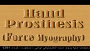 دست الکترونیکی ایرانی-دستاورد