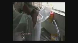 خارج کردن تومور 8 کیلویی از بدن یک بیمار ایرانی