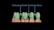 آموزش دندانسازی - آموزش وکسینگ و ساخت فریم مومی