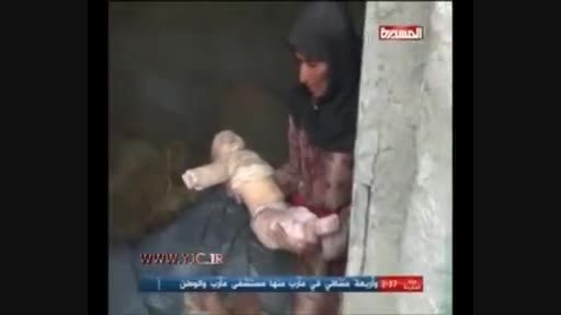 شهادت نوزاد 8 ماهه در یمن توسط آل سعود