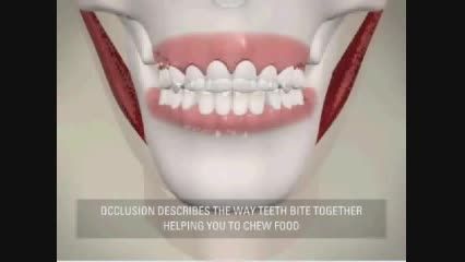 پوستریور دندان (posterior)