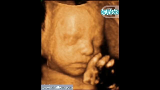 سونوگرافی چهار بعدی در بارداری هفته بیست و ششم
