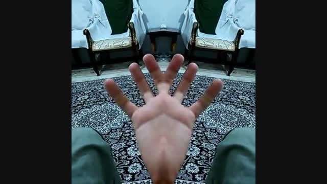 عجیب ترین انسان دنیا در ایران با ۶ انگشت !!!!!
