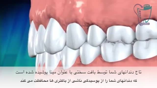 پوسیدگی دندان و افزایش سن | سیمادنت