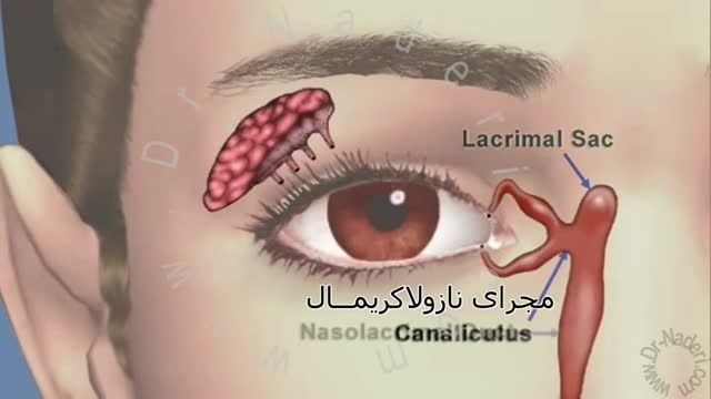 اناتومی سیستم اشکی-ساختمان چشم-مرکزچشم پزشکی دکتر نادری