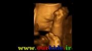 سونوگرافی 3 بعدی از جنین داخل رحم Www.ourkids.ir