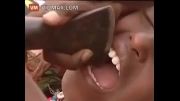 دندان پزشک در افریقا ... حتما ببینید