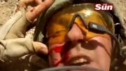 خوردن تیر به صورت سرباز انگلیسی در افغانستان