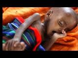 فقر در سومالی 2