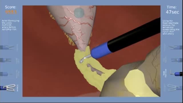 Laparoscopic Cholecystectomy Simulation - Overview