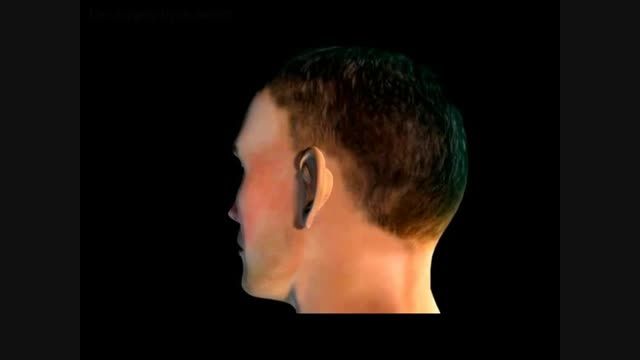 Ear surgery animation by dr.emami