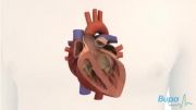 Heart valve repair surgery