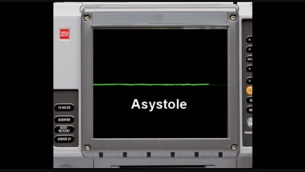 Asystole-EKG