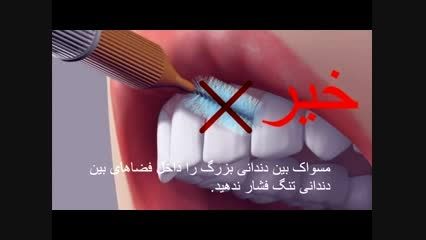 تمیز کردن صحیح بین دندانها