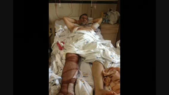 زخمی شدن سردار شهابی فر به دست داعش