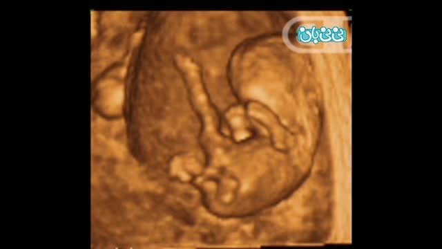 سونوگرافی چهار بعدی در بارداری هفته هشتم