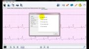 نرم افزار تحلیل سیگنال هولتر ECG نسخه 3 -امکانات بصری 3