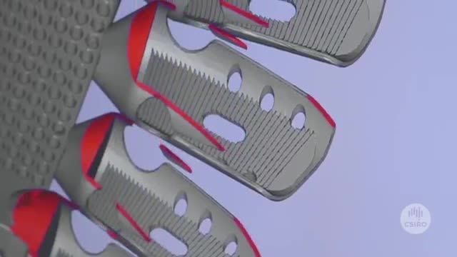شگفتی پزشکی : ساخت اولین قفسه سینه توسط پرینت سه بعدی