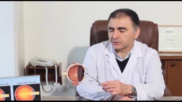 دکتر فرید کریمیان- لنز داخل چشمی