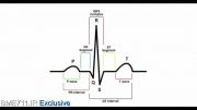 cardiac conditions system