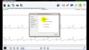 نرم افزار تحلیل سیگنال هولتر ECG نسخه 3 -امکانات بصری 2