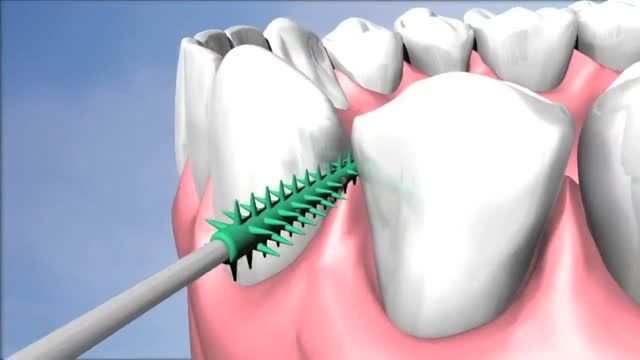 روش استفاده از مسواک بین دندانی - سافت پیکس GUM