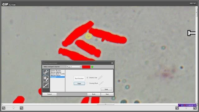 کاربرد نرم افزار پردازش تصویر در کاریوتایپ کروموزوم